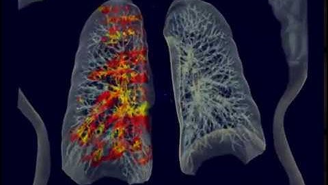 Volumetric rendering of gaze coverage (eye tracking, CT scan)