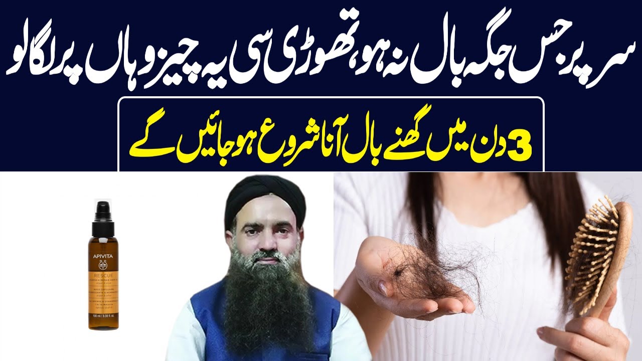 𝓗𝓸𝔀 𝓣𝓸 𝓢𝓽𝓸𝓹𝓹𝓮𝓭 𝓞𝓾𝓻 𝓗𝓪𝓲𝓻 𝓕𝓪𝓵𝓵 Hair fall solution at Home Hair fall