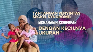 Mengetahui Seckel Syndrome Pada Anak