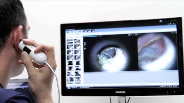 Dino-Lite AM311H / AM3111H Handheld Digital Earscope