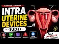 3 Minute NEET Biology Revision — IUDs
