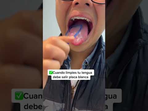 Video: 3 formas de limpiarse la lengua sin arcadas