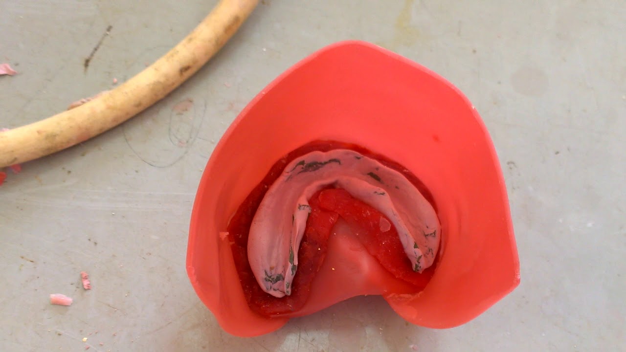 boxing empreinte secondaire inf