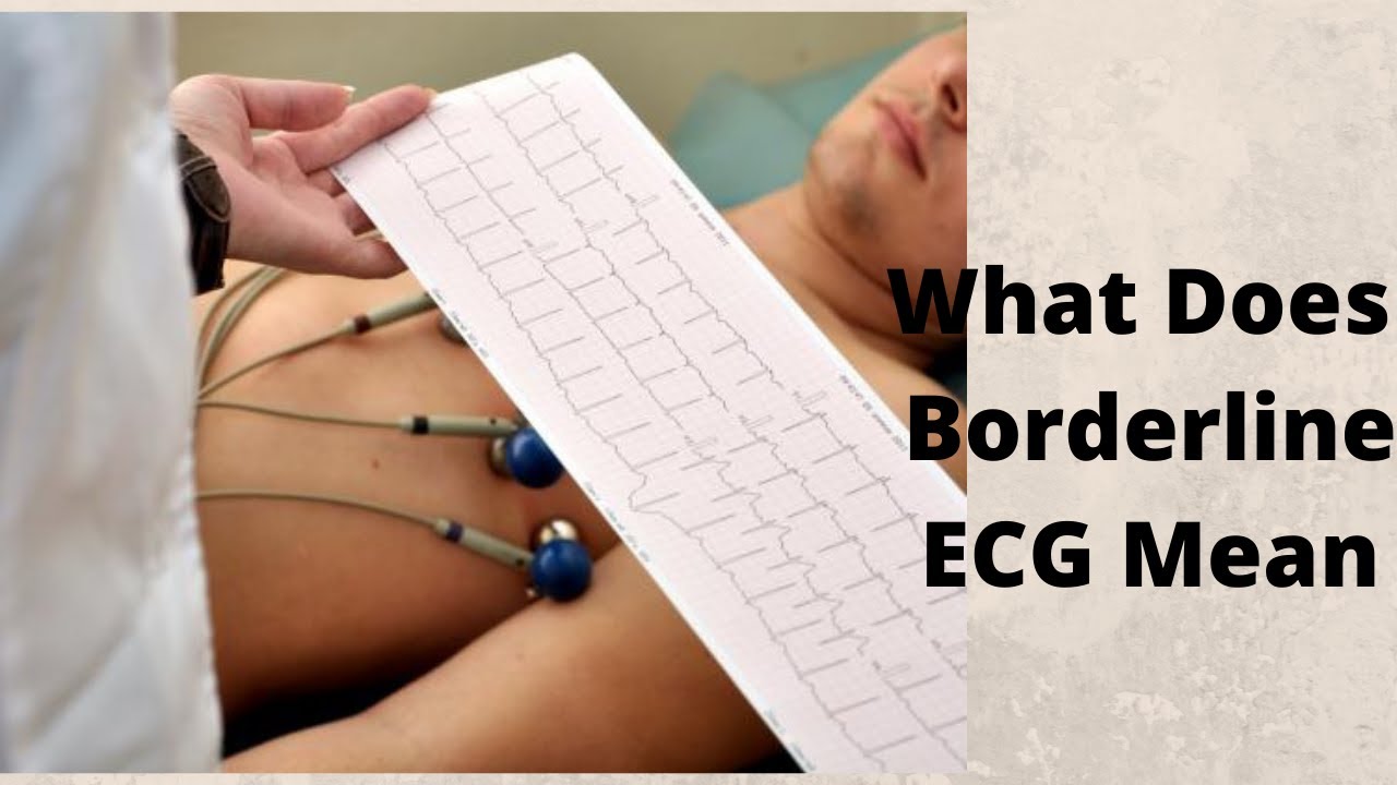 Is Borderline ECG Dangerous? Understanding Your ECG Reports