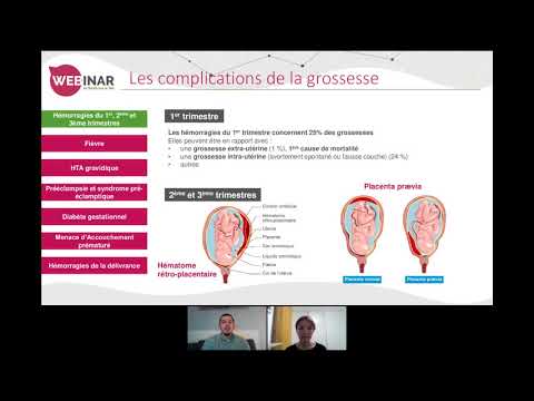 Vidéo: Pertinence Et Opportunité De La Recherche De Soins Pour Les Complications De La Grossesse Et De L'accouchement Dans Les Régions Rurales De L'Éthiopie: Une étude De Cas Du