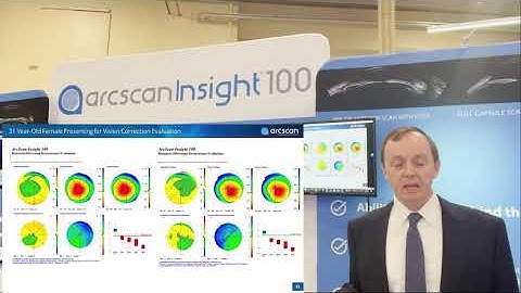 Dr. Michael Manning and ArcScan: A Vital Tool for Refractive Surgery
