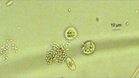 amoeba dividing (prob. Cochliopodium)