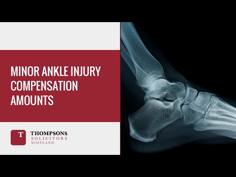 Minor Ankle Injury Compensation Claims