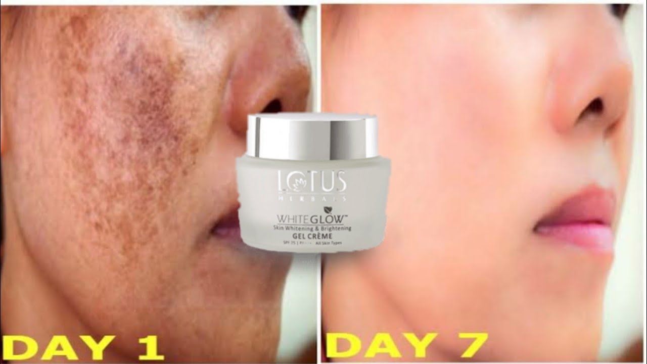 daag dhabbe hatane ki creamlotus herbal white glow gel cream review by