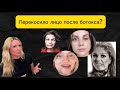 Почему после ботокса перекосило лицо ?