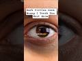Dark Circles Gone Wrong | Truth You Must Know