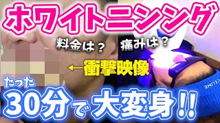 【実体験】ホワイトニングだと思ったら凄テク施術だったwww