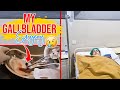 Gallbladder Laparoscopy Journey | Natasha Waqas Vlogs