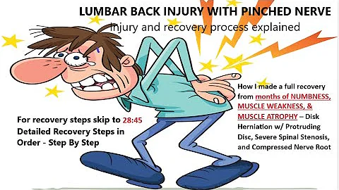 100% RECOVERY! Lumbar Injury: Spinal Stenosis, Com...