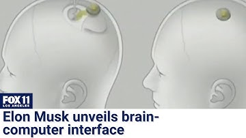 Neuralink: Elon Musk unveils brain-computer chip technology