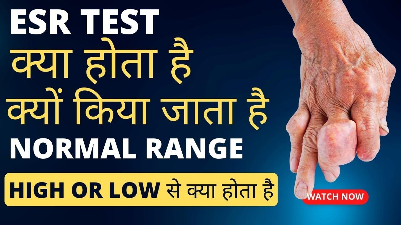 ESR test kya hota hai esr badhne se kya hota hai esr test hindi