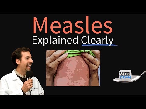 Measles (rubeola) Explained Clearly by MedCram.com