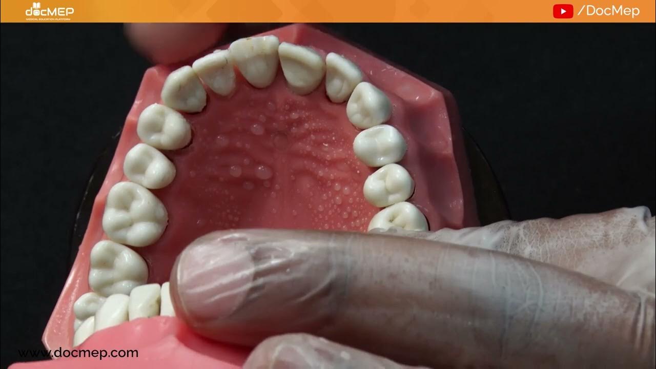 Incisal Reduction for Tooth Preparation PFM Crown Prep in Anterior Tooth YouTube