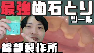 【気持ちいい位取れる】ベッタリ付いた歯石がみるみる取れる衝撃映像！！