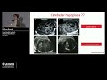 ISUOG 2022 - Dr. Mona Massoud - What's new about prenatal cerebellar hypoplasia?