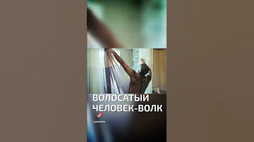 Волосатый человек-волк  - необычные люди