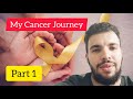 My cancer journey part 1  cancer is not the end living with ewing sarcoma