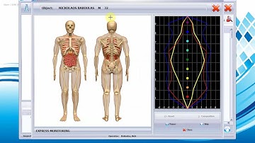 Sensitiv Imago (SI) Key Concepts: What the Colours Mean During a Scan!
