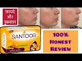 Honest Review After Use | Santoor Soap | Benefits and losses of using this #santoor #santoorsoap