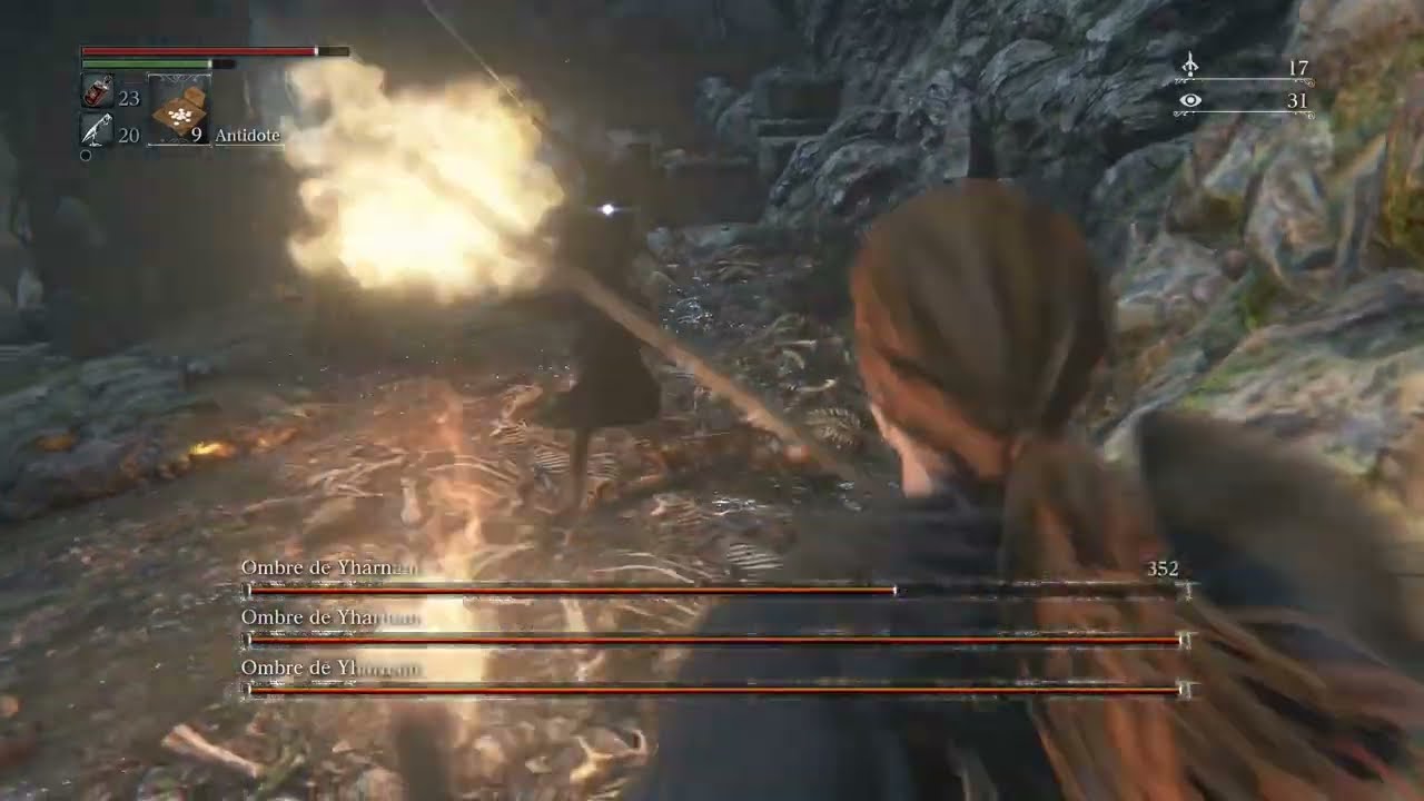 [Bloodborne] Shadow of Yharnam (First Playthrough)