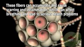 Asbestos Removal Port St. Lucie