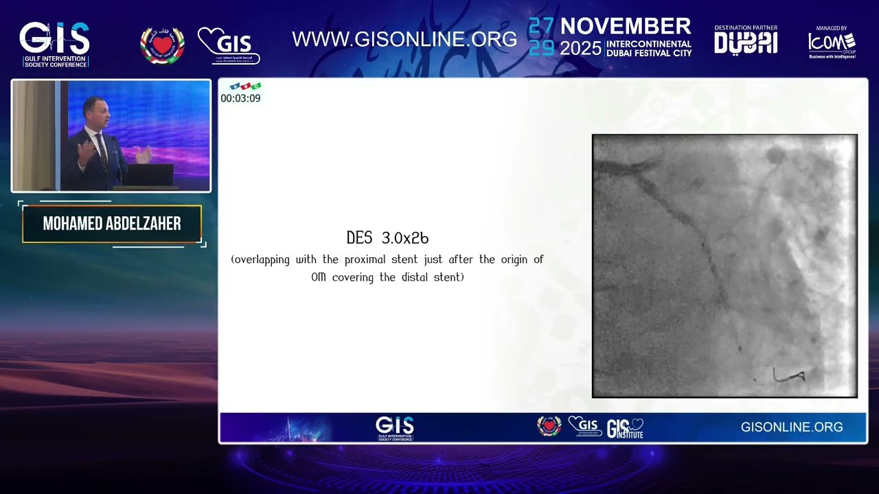 18 Hidden Side of DCB Angioplasty  Exploring a Rare No Reflow Type Mohamed Abdelzaher