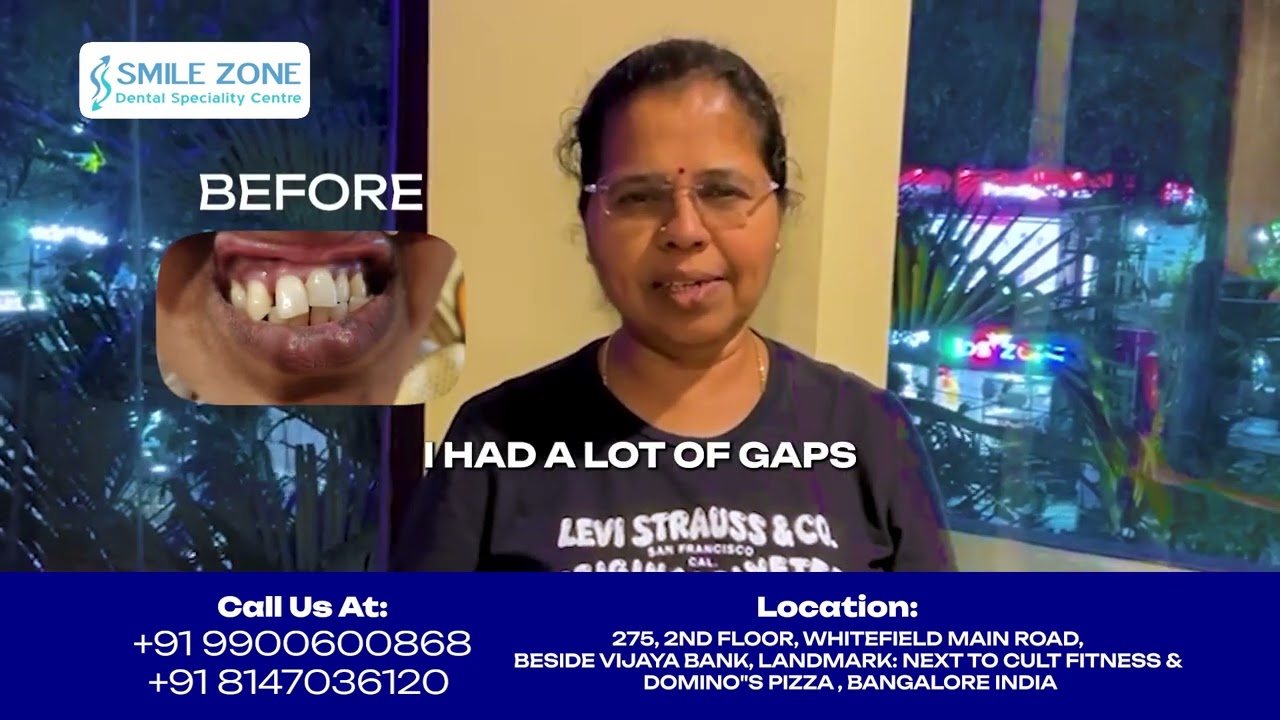 A Smile That Travels: Best dental clinic in Bangalore | Smile Zone