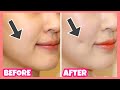 Create Dimples Fast and Naturally! Dimples Exercises & Massage