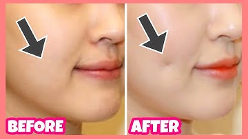 Create Dimples Fast and Naturally! Dimples Exercises & Massage