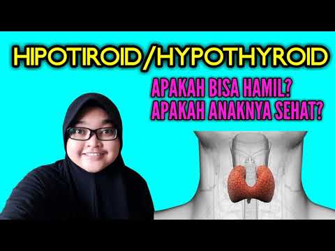 Video: Hipoplasia Kelenjar Tiroid Pada Orang Dewasa, Anak-anak, Remaja Dan Wanita