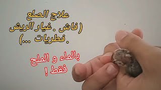 علاج الصلع عند الحسون و الكناري