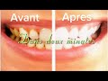 Des dents propres en seulement 2 minutes#remedenaturel #soinvisage #detox