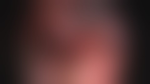 Laparoscopic cholecystectomy (LC) and intraoperative cholangiography (IOC)