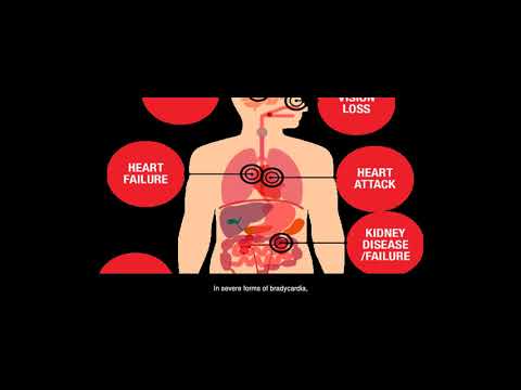 Video: Low Pulse At High Pressure: What To Do, Causes, Treatment