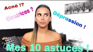 10 ASTUCES CONTRE L'ACNÉ ! Mario Badescu ,Cicalfat ,Sanoflore