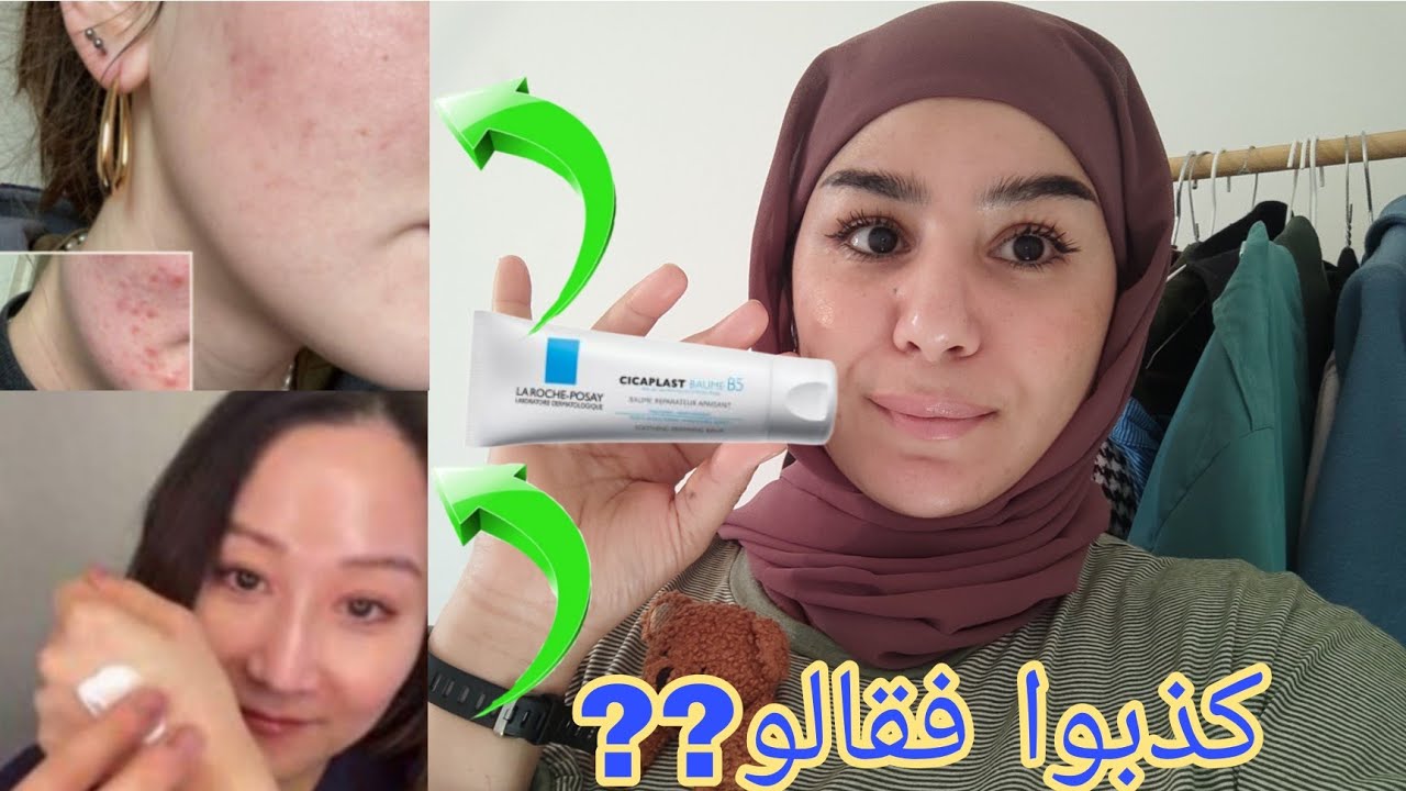 أخطاء شائعة  عند استعمال cicaplast baume B5! هل تعالج الكلف و التصبغات? سر البشرة الزجاجية? غتصدمي🤯