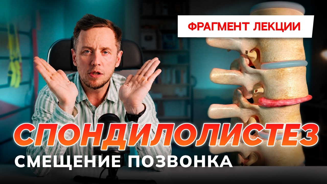 Спондилолистез: тактика ведения пациента. Патогенез и прогноз.