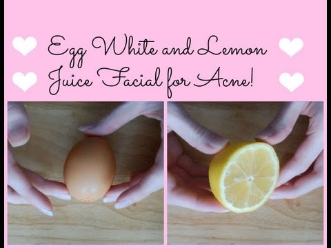 Egg White and Lemon Juice Facial for Acne! How to Clear Acne Naturally ♥