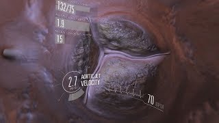 VR Medical Animation - Virtual Heart Valve I Sliced Bread Animation
