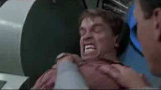 John Lost His Marbles