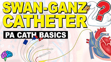 The BASICS of the Pulmonary Artery Catheter