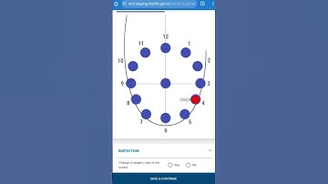 National NCD Portal - Breast Cancer (Confirmed Diagnosis at CHC/DH)
