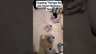 Cupping Therapy By Jim Street Wellness Spa