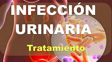 ¿Cómo tratar una ITU sin antibióticos?