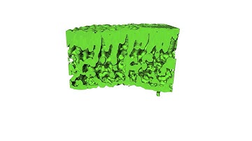 Synchrotron X-ray laminography of tomato leaf